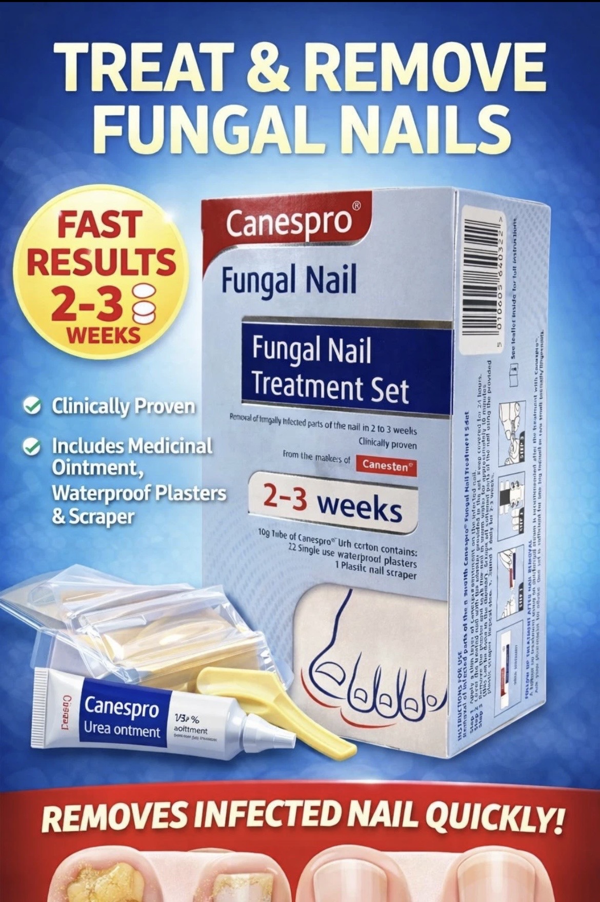 Canespro Fungal Nail Treatment Set retail pack containing urea ointment, plasters and nail scraper